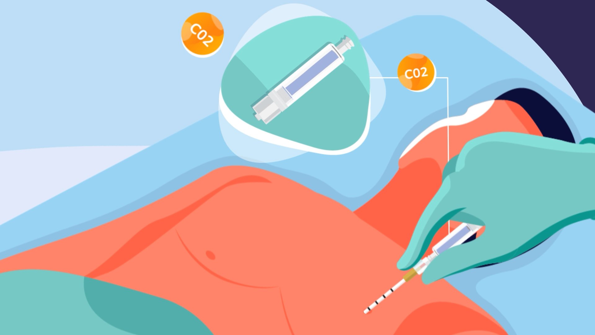 Capnospot Indicator CO2 Purple