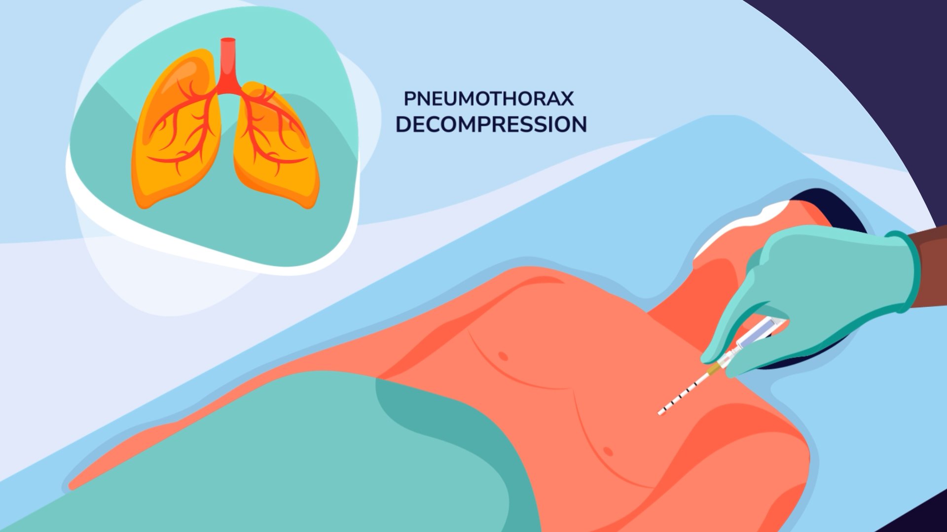 Capnospot Indicator Use