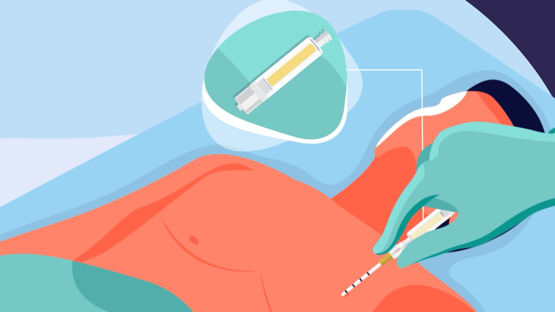 Capnospot Indicator Yellow