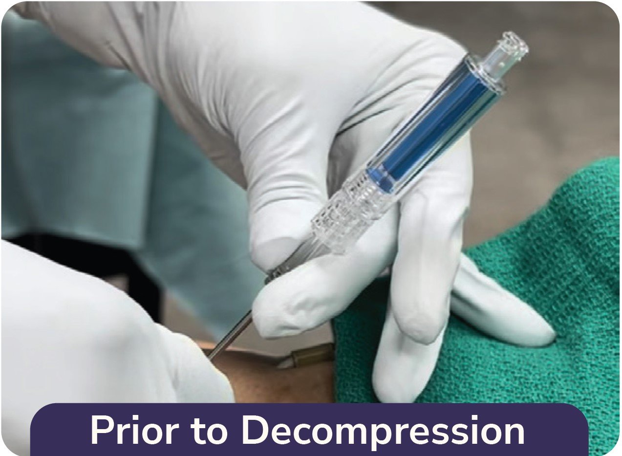 Capnospot Prior to Decompression