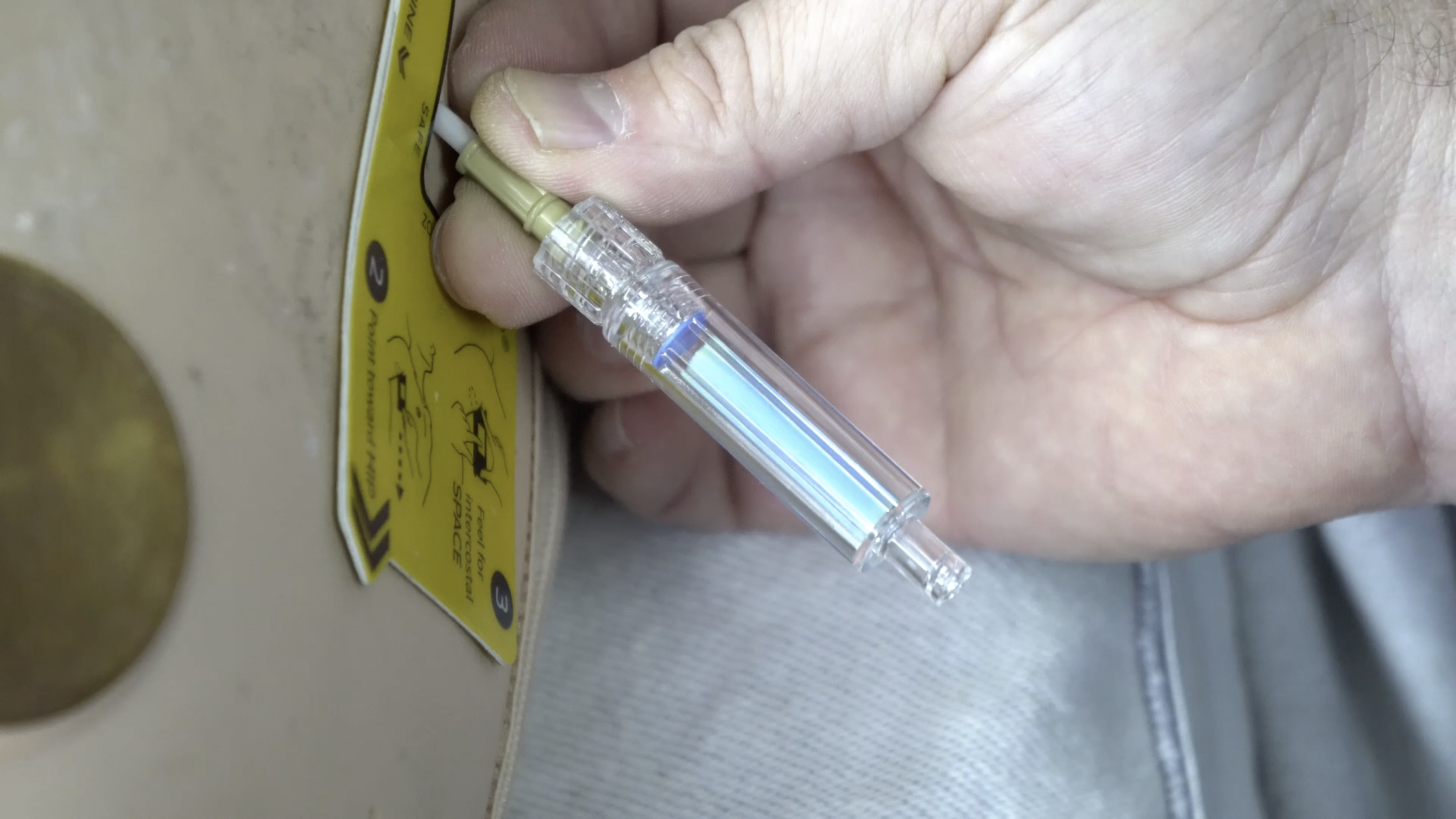 Capnospot In Use - Preinsertion