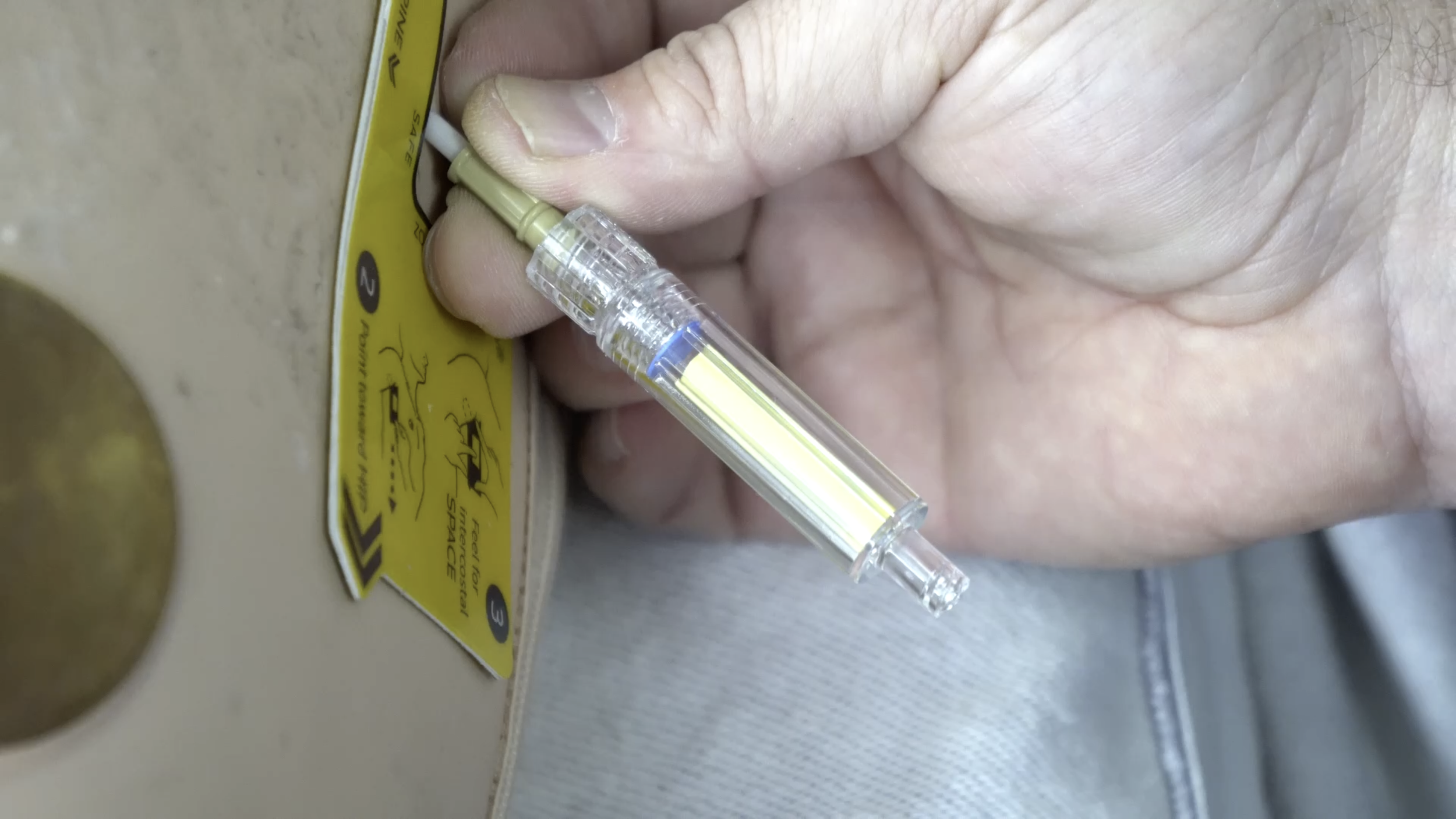 Capnospot In Use - Success